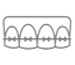 Orthodontic Treatment Braces
