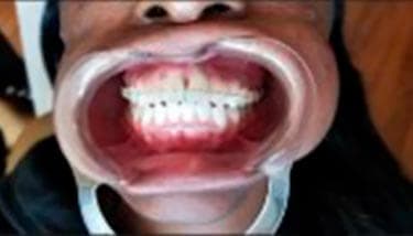 milestone-dentistry-03a