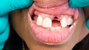milestone-dentistry-04b