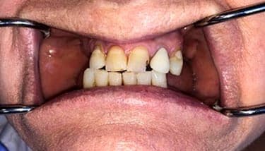 milestone-dentistry-06b