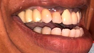 milestone-dentistry-07a