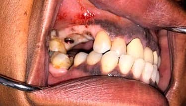 milestone-dentistry-07b