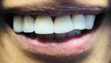 milestone-dentistry-09a