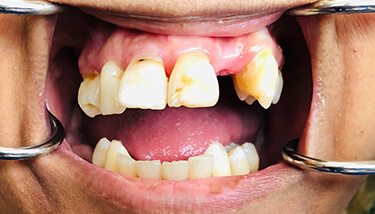 milestone-dentistry-10a