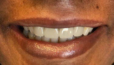 milestone-dentistry-11a