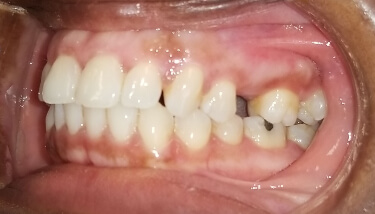 milestone-dentistry-12a