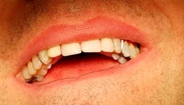 milestone-dentistry-01a milestone-dentistry-01a