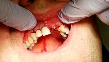 milestone-dentistry-01b milestone-dentistry-01b