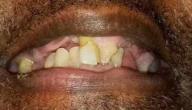 milestone-dentistry-02b milestone-dentistry-02b