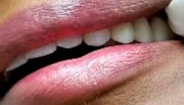 milestone-dentistry-05a milestone-dentistry-05a