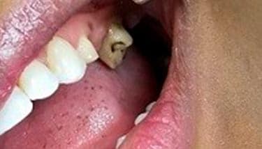 milestone-dentistry-05b milestone-dentistry-05b