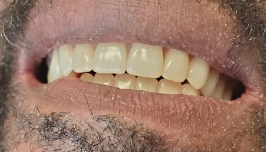 milestone-dentistry-08a milestone-dentistry-08a