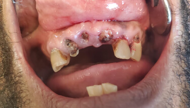 milestone-dentistry-08b milestone-dentistry-08b