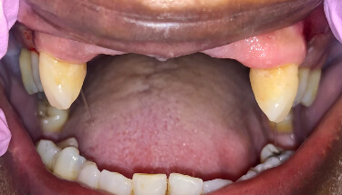 milestone-dentistry-11b milestone-dentistry-11b