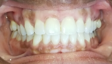 milestone-dentistry-12b milestone-dentistry-12b